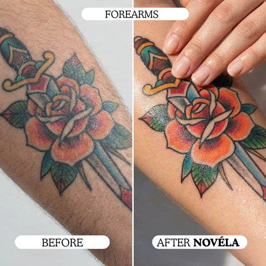 Finer, Fewer Facial Hairs in 30 Days With the Novéla Root System